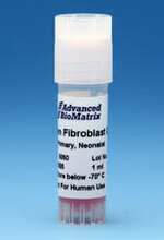 fibroblasts.jpg fibroblasts.jpg