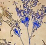 penicillium-chrysogenum-spores.jpg
