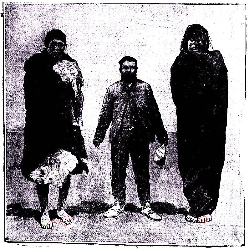 OnasToes7-ft.JPG OnasToes7-ft.JPG