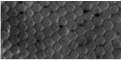 Cross-section-of-human-retina-showing-the-hexagonal-structure-of-the-photoreceptor-cones.png